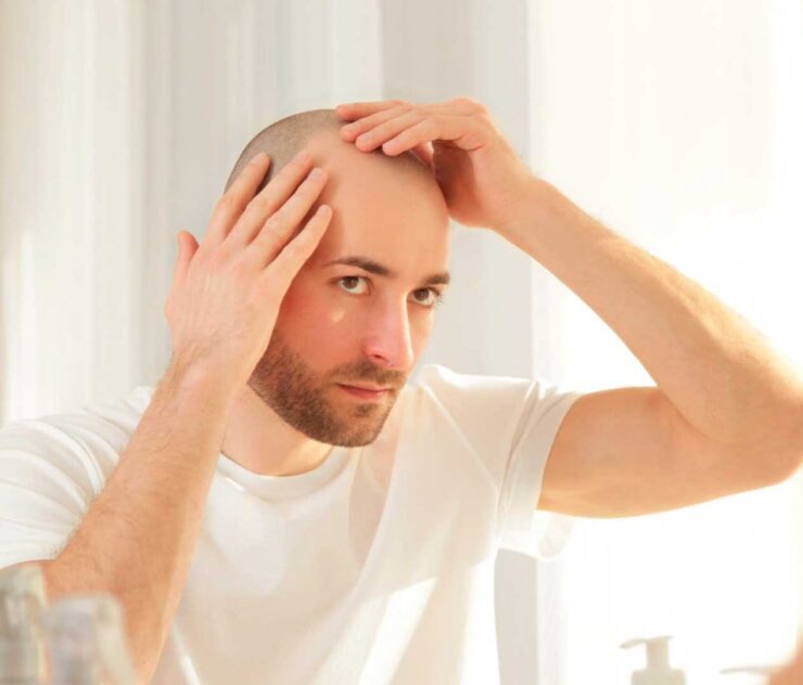 Hombre con la cabeza rasurada mirandose al espejo - Homme Luxury Barbers