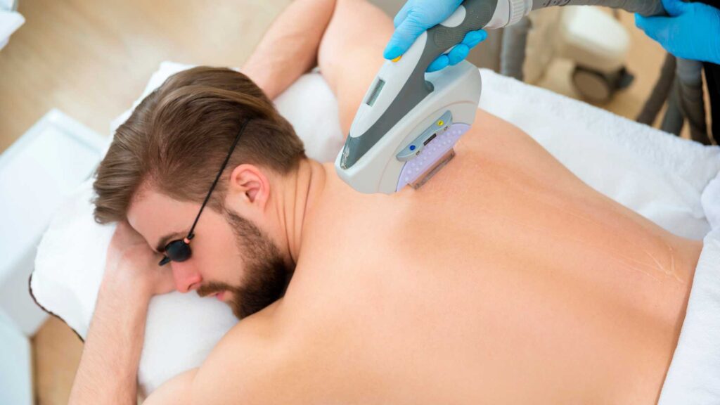 Hombre acostado recibiendo depilación láser en la espalda - Homme Luxury Barbers